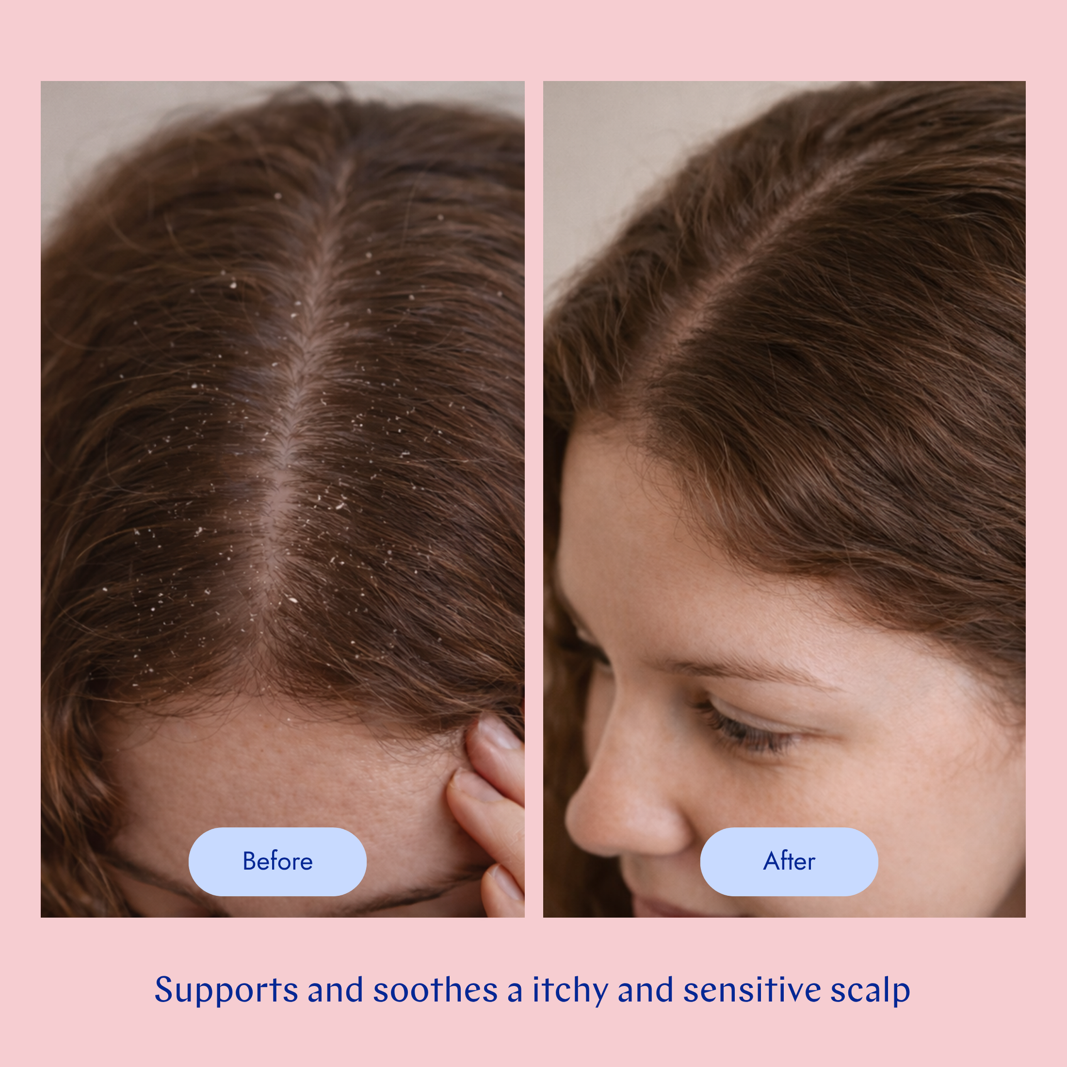 Scalp Care Scrub